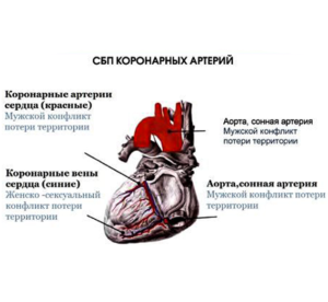 Коронарный инфаркт